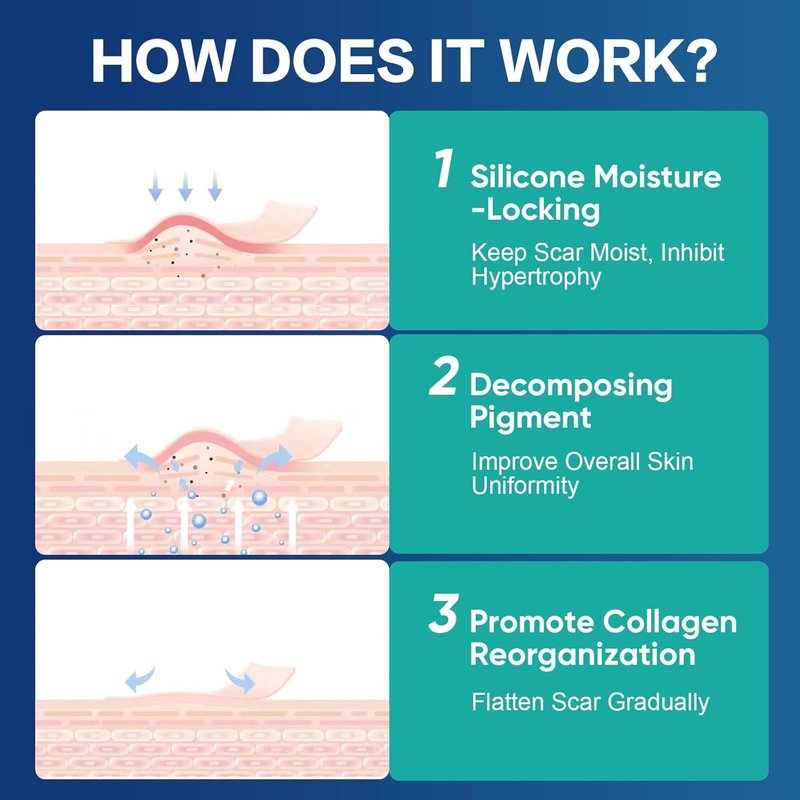 Medical Grade Silicone Scar Sheets - Advanced Treatment for Surgical, Burn & Keloid Scars | Flexible 4"x4" Strips