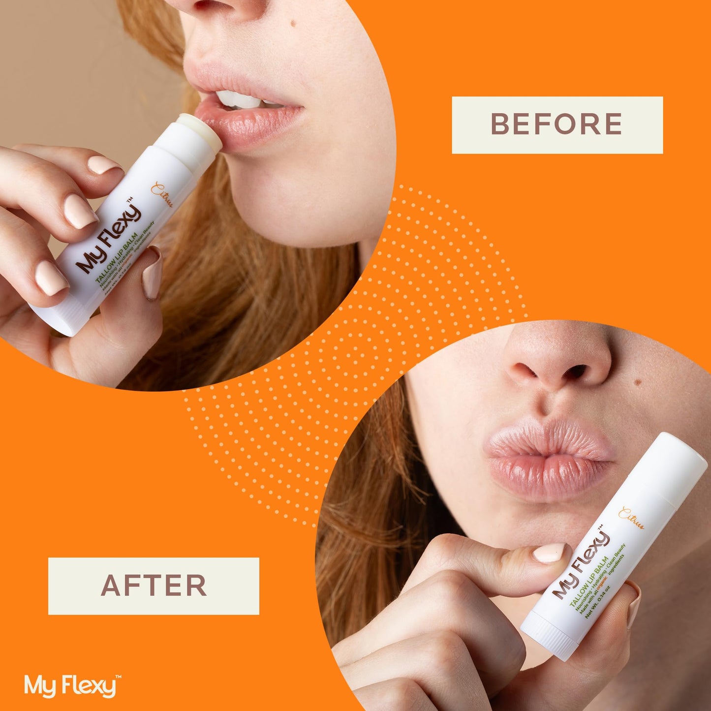 My Flexy 100% Organic Lip Balm Hydrating, Grass-Fed Beef Tallow Lip Balm, Made with Pasture Raised Tallow, Honey, Beeswax, & Orange Essential Oil, Lip Balms & Moisturizers - 1 Pack