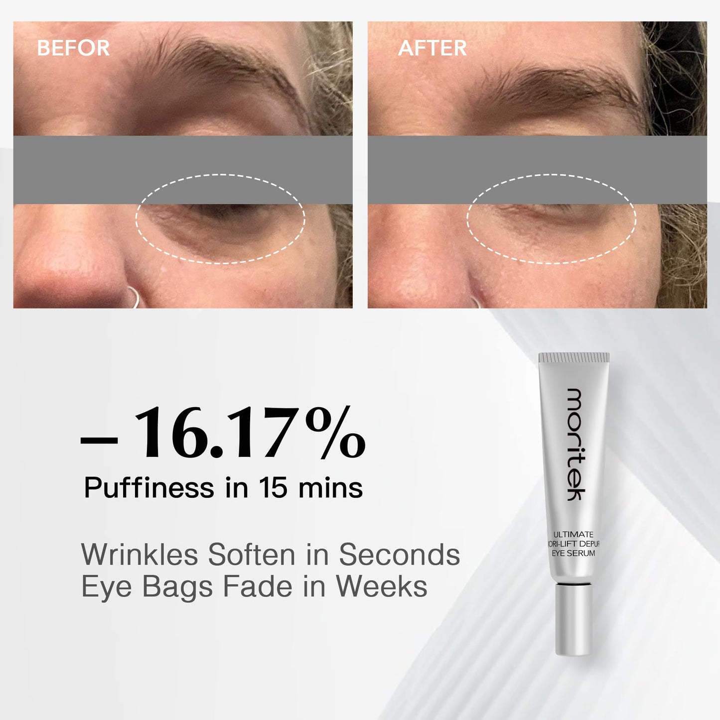 MORlTEK Deep Anti-Aging Wrinkle Remover & Eye Serum Visibly Reduces Under-Eye Bags, Puffiness, Dark Circles, Wrinkles, Fine Lines & Crow's Feet Instantly