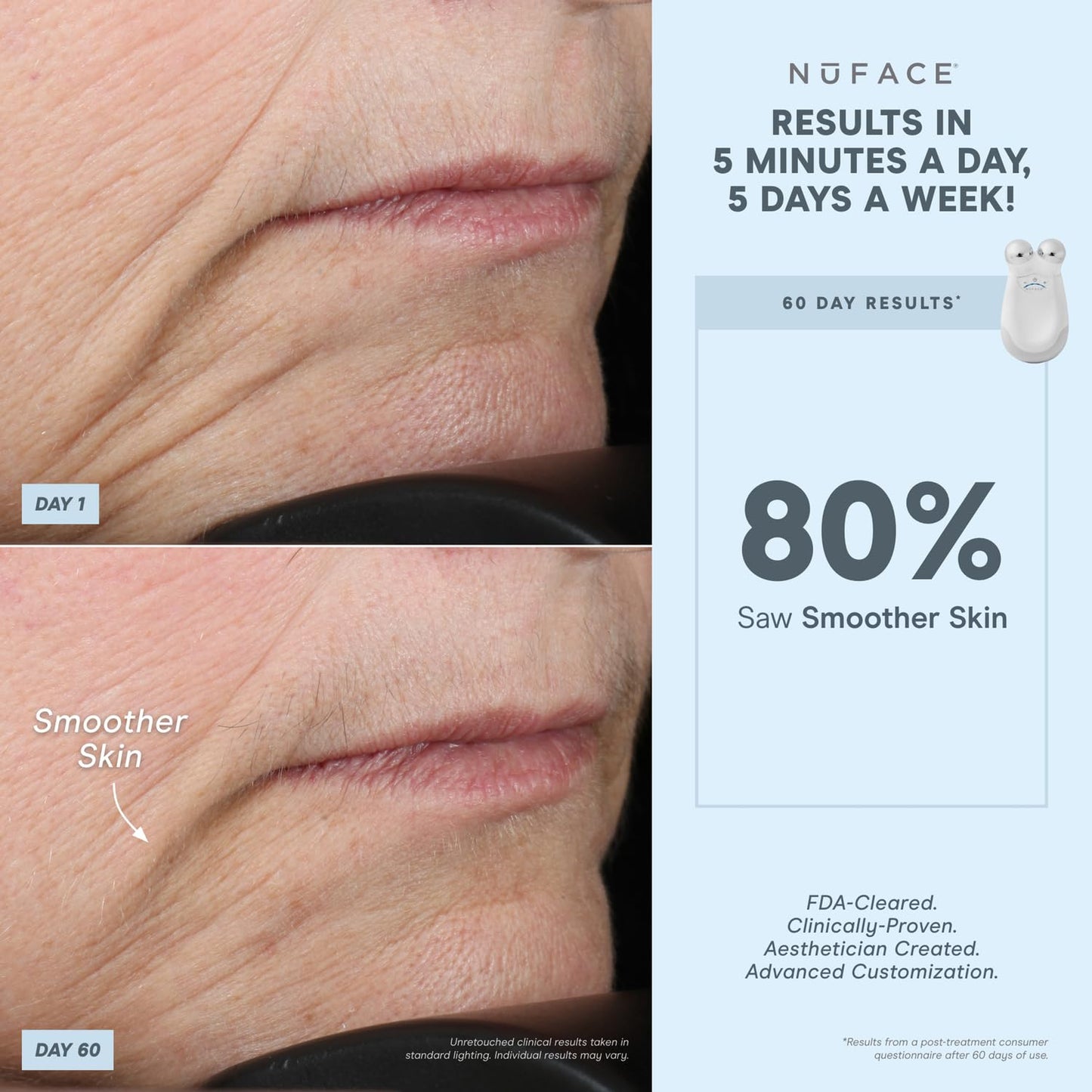 NuFACE Trinity FDA Cleared Microcurrent Facial Device + Effective Lip & Eye Attachment - Face Sculpting & Neck Tightening Device to Contour Cheeks, Brows & Mouth - With Hydrating Microcurrent Gel