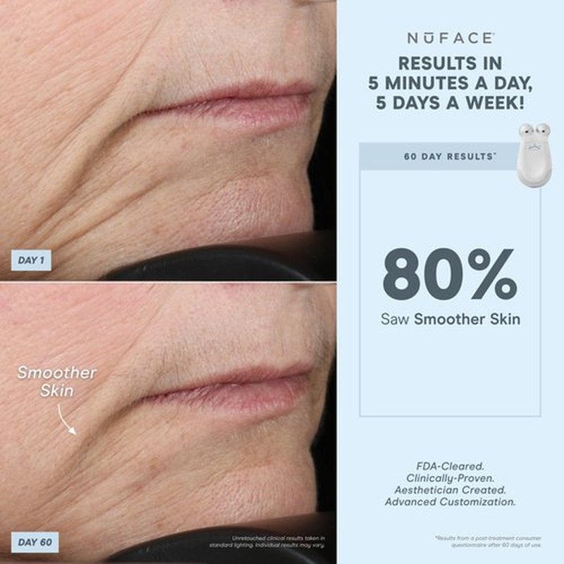NuFACE FDA Cleared Effective Lip & Eye Attachment for Trinity Microcurrent Facial Device - at Home Eye Lift & Smile Lines Treatment to Tighten and Tone Hard-to-Reach Areas Around Mouth and Eyes