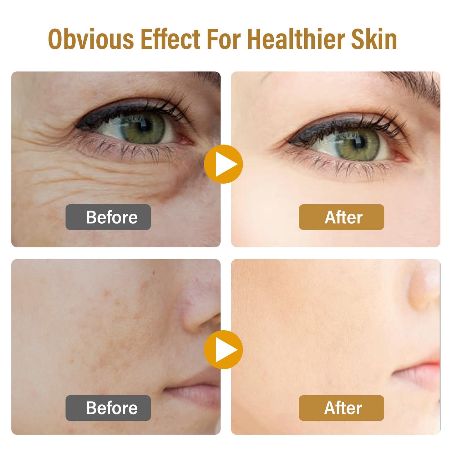 Bee Venom Skin Treatment Cream, Natural Face Lifting and Firming, Reduces Skin Blemishes, Gentle and Non-Irritating for All Skin Types,60ml