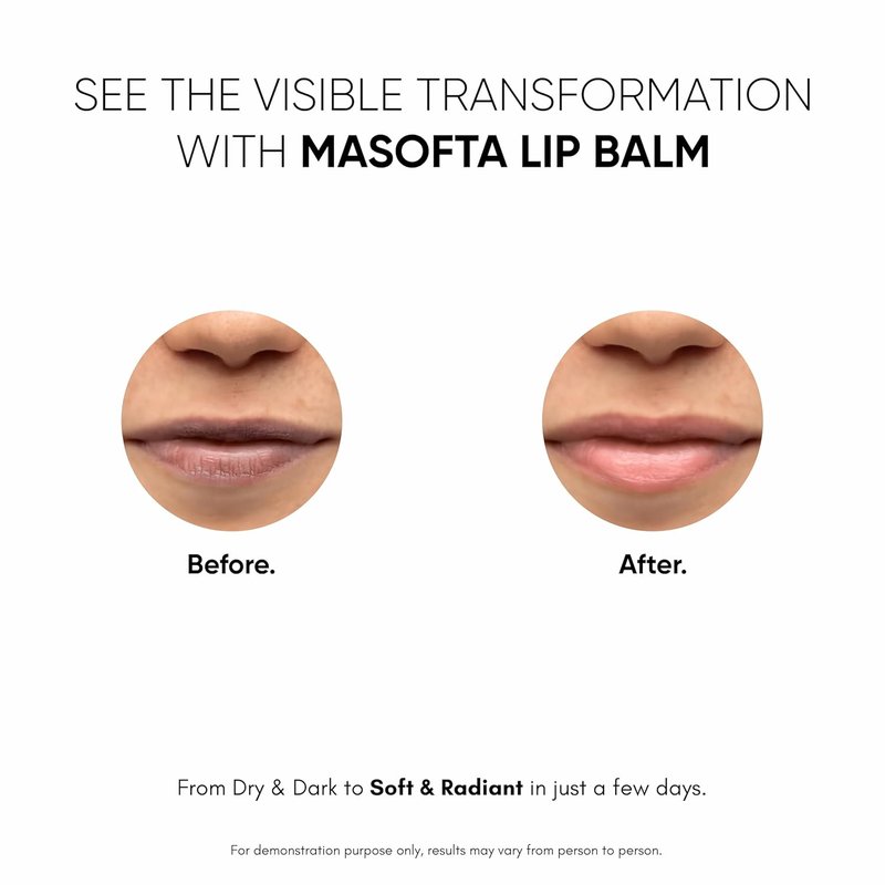 Shea Butter Lip Balm with Kojic Acid & Alpha Arbutin - Smooth, Hydrated Lips | SPF 30, 0.52 oz