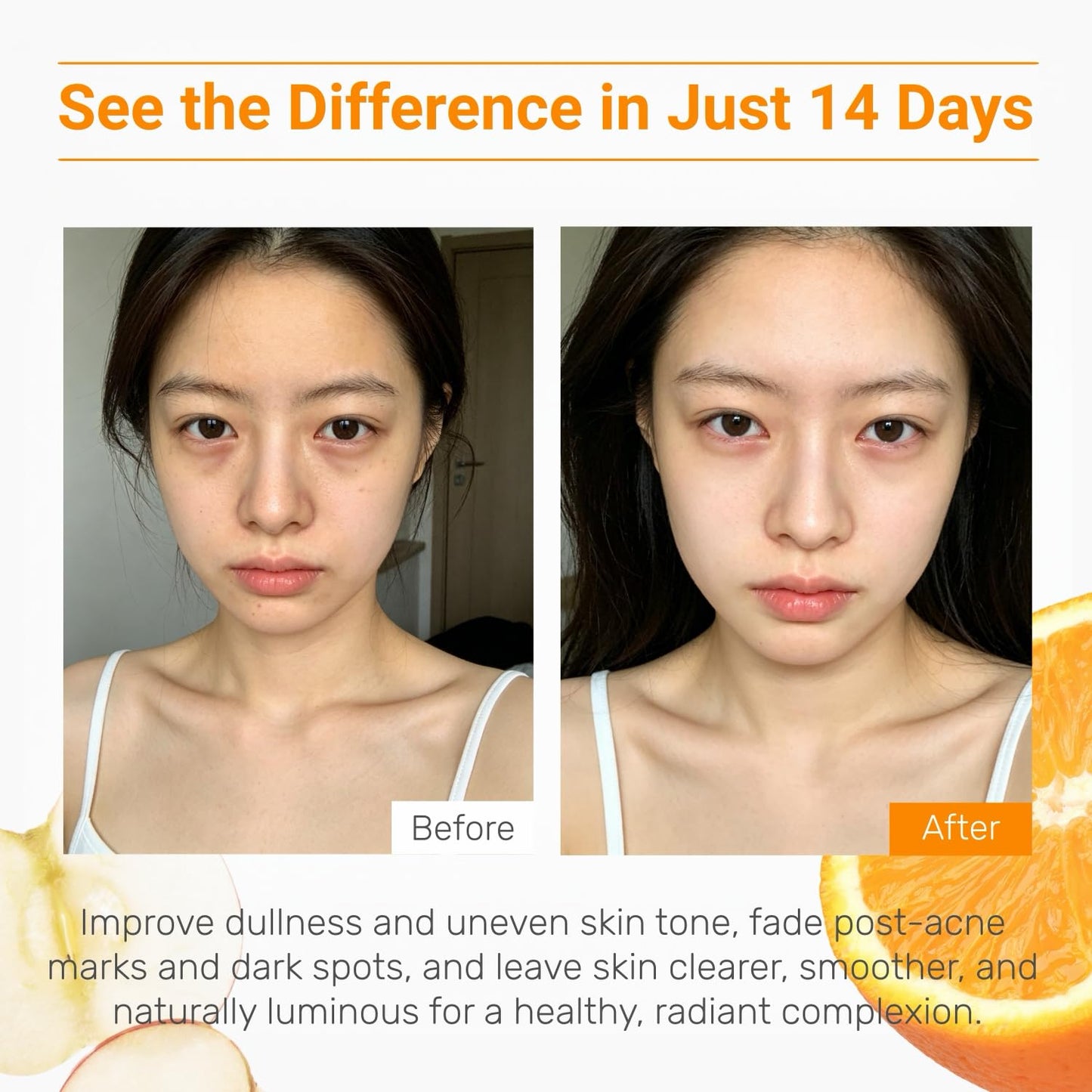 WNP Vitamin C Serum for Face - Dermatologist Tested Anti-Aging & Brightening with Hyaluronic Acid & Vitamin E, Treatment for Dark, Age, Sun Spot, Melasma, Hyperpigmentation, Fine Lines & Wrinkles