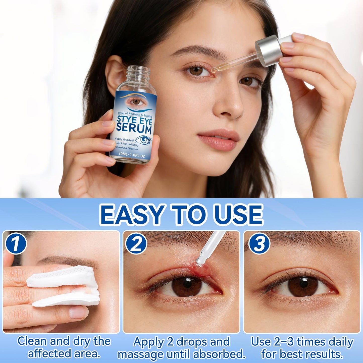 Stye Eye Treatment, 30ml Natural Eye Serum, Eye Stye Relief Serum for Eye Styes, Blepharitis, Chalazions and Dry Eyes Treatment, Daily Area Cleansing, Relieves Dryness and Restores Healthier Skin