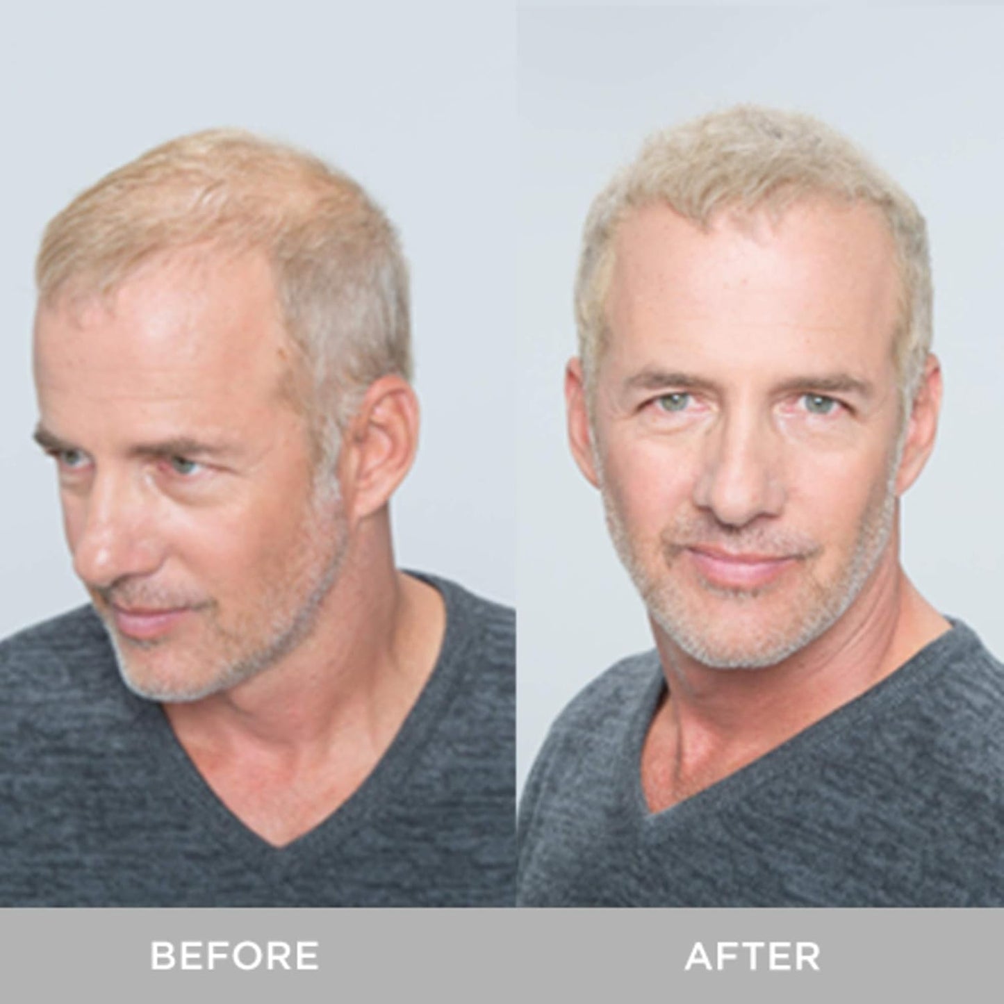 XFusion Keratin Hair Fibers - Medium Blonde (15g).
