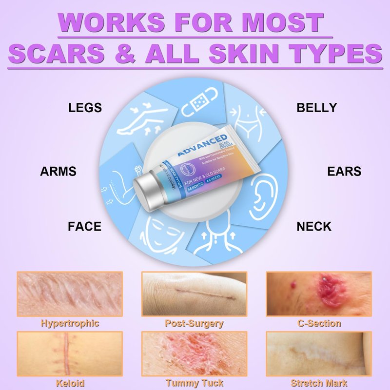 Silicone Scar Cream Gel - Advanced Treatment for Surgical Scars, Keloids, Acne & Stretch Marks | 1.23 Oz (35g)