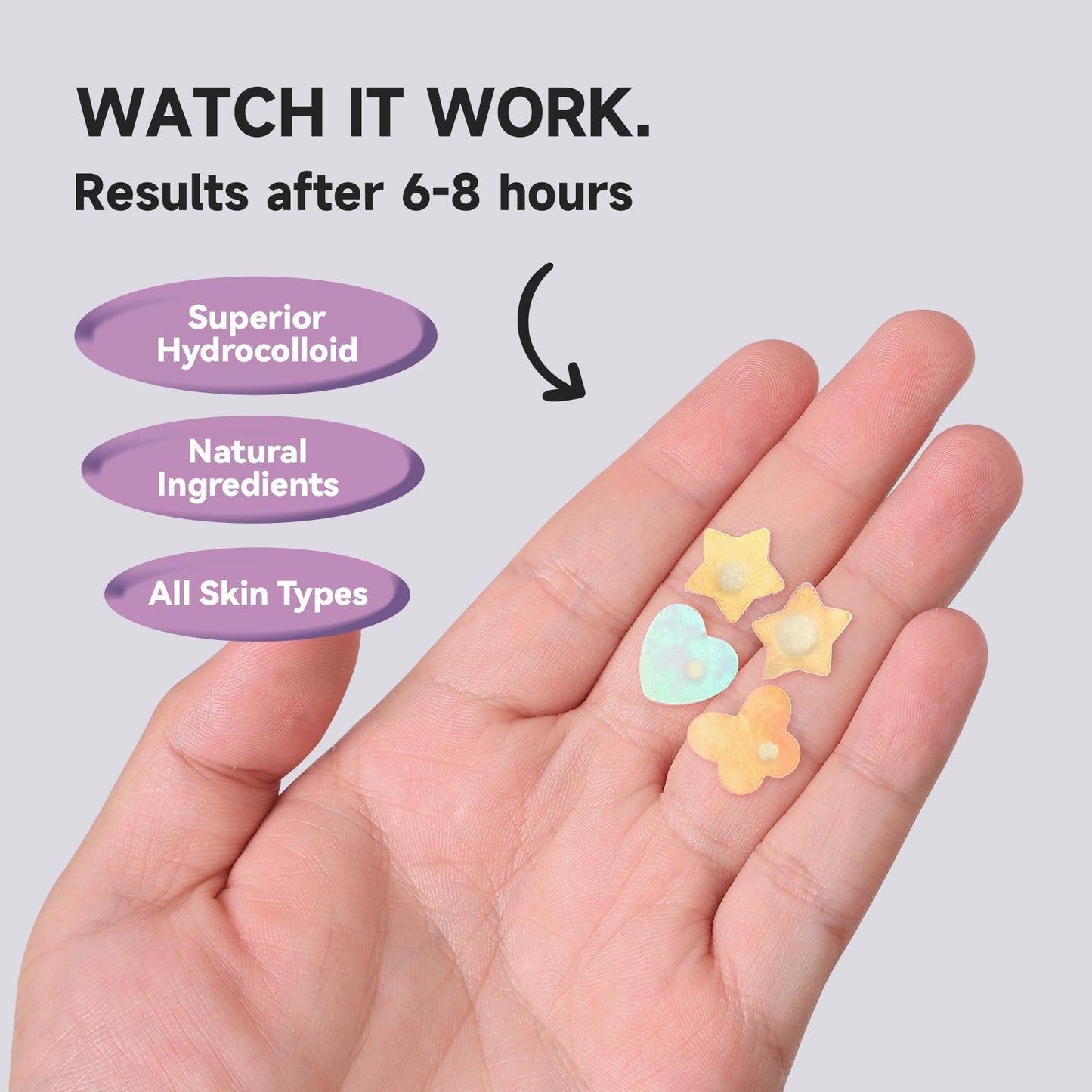 Dazzlook Cute Pink Heart Pimple Patch with Salicylic Acid, Hydrocolloid Pimple Stickers Iridescent Colors 48 Pcs, Fashion Zits Blemishes Breakouts Patches