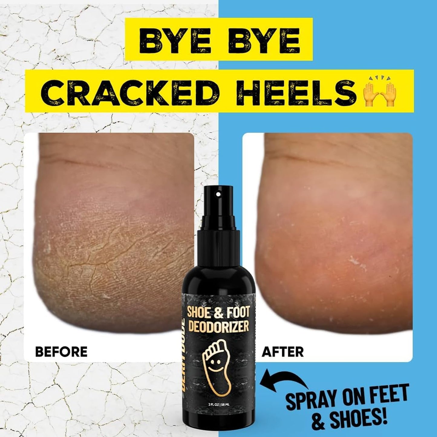 Derm Dude Foot & Shoe Deodorizer Spray | Formulated With All-Natural DeoPlex for Odor Control | Witch Hazel, Aloe Vera, Tea Tree Oil & Peppermint to Freshen Feet & Shoes | Travel Size, Mint Scent 2 oz