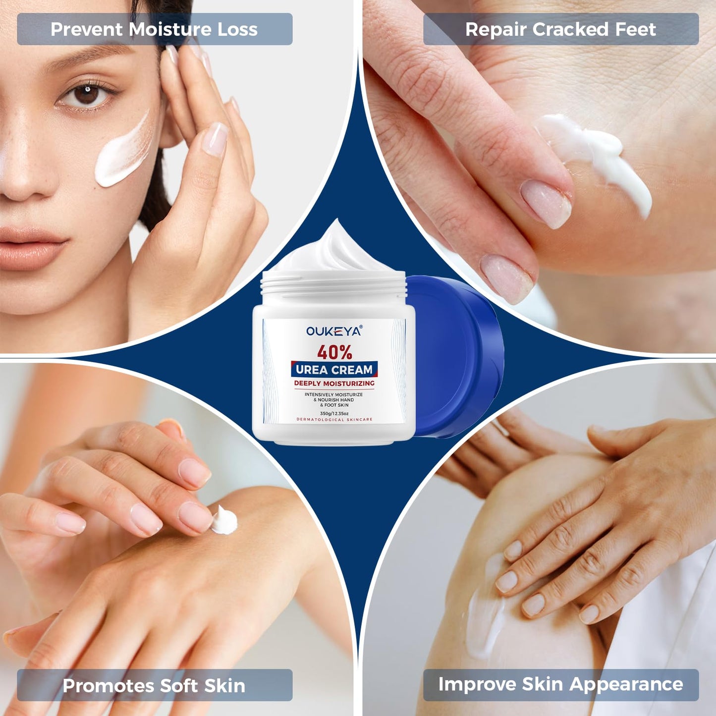 OUKEYA Urea Cream 40 Percent, Foot & Hand Cream for Dry Cracked, Urea Lotion for Feet Maximum Strength