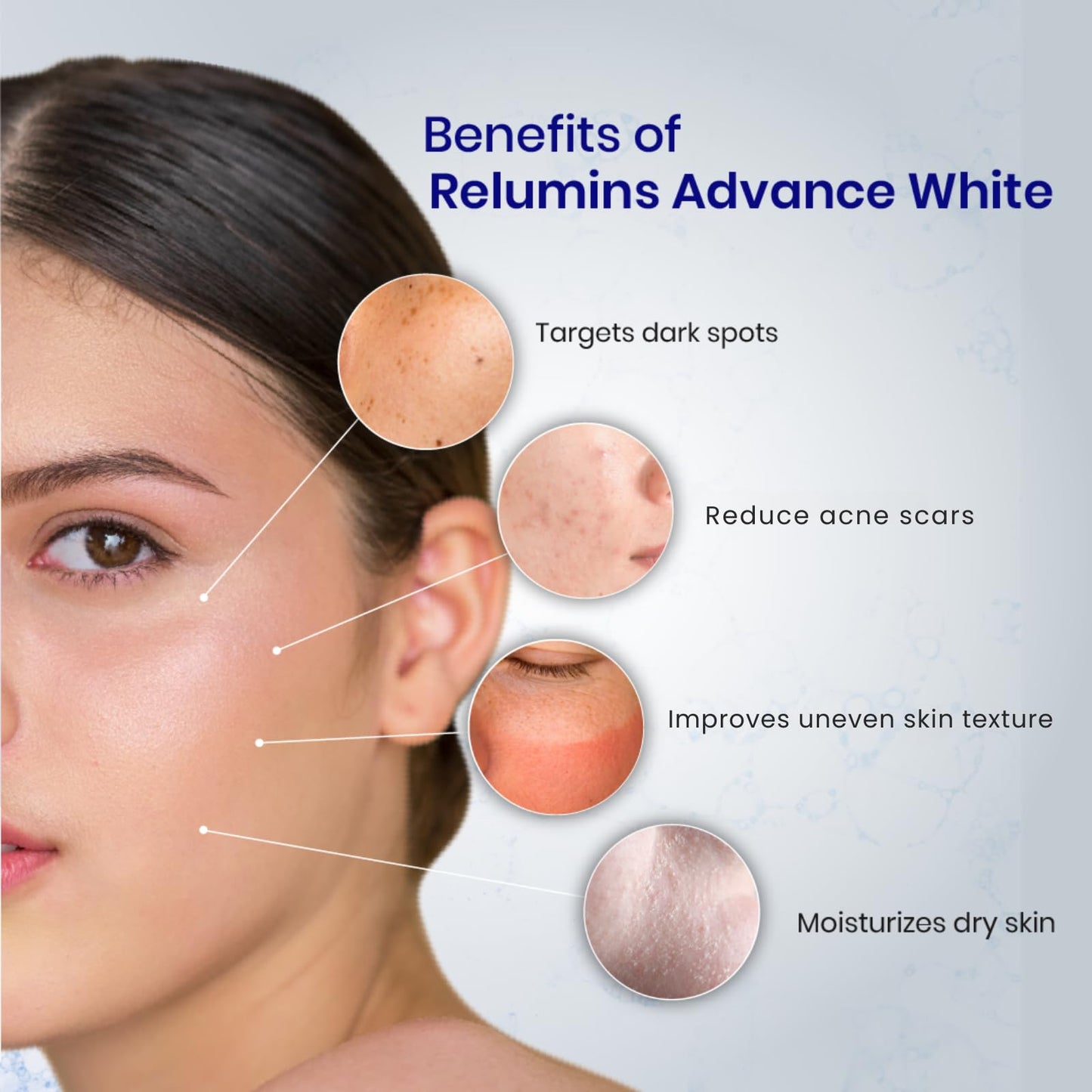 Relumins Advanced White Glutathione Capsules - Max Strength Brightening Supplement with ALA, Placenta, Rose HIPS & Vitamin C - Fights Oxidative Stress, Supports Collagen & Made in USA - 10 Bottles