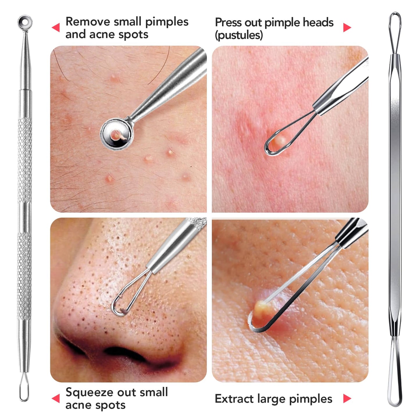 Litbear 6 Pcs Blackhead Remover Tools,Pimple Popper Tool Kit,Blackhead Pimple Comedones Extractor,Acne Tools Extractor kit, Scraper for Face Nose Deep Cleansing with Leather Case