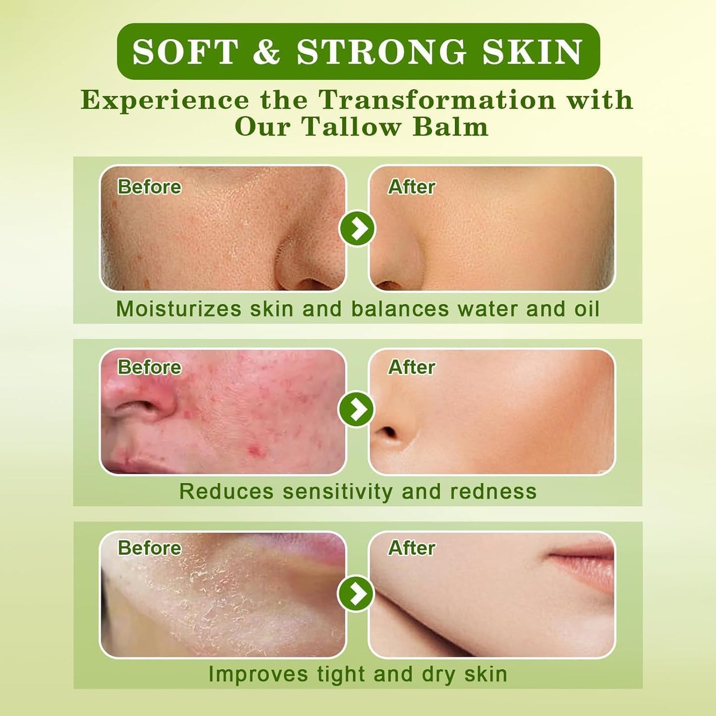 WEILNELL Beef Tallow for Skin, Tallow Face Moisturizer (4 Oz), Organic Grass Fed Beef Tallow Blam, Natural Moisturizer Hydrating Beef Tallow Cream, Deeply Moisturizing for Face & Body Skincare