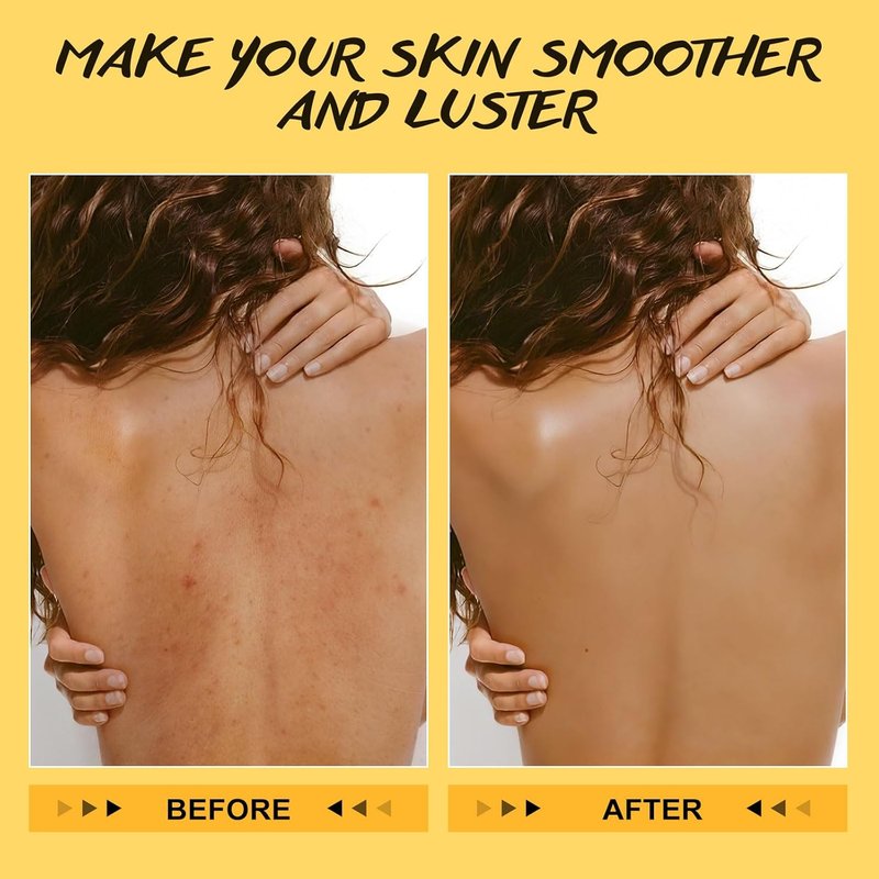 Turmeric & Vitamin C Body Scrub - Natural Exfoliating Deep Cleanser for Skin Brightening | 8 oz
