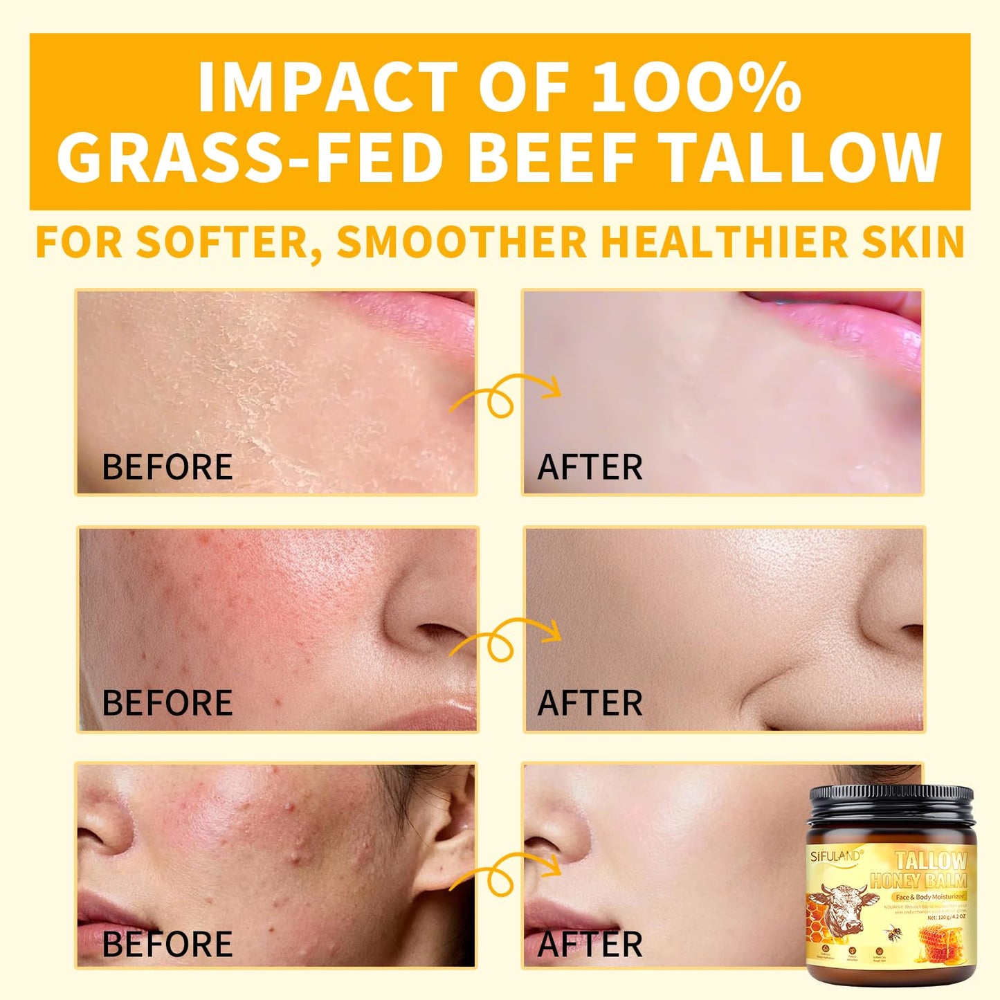 SiFULAND Beef Tallow for Skin, 100% Organic Grass-Fed Beef Tallow & Raw Honey Balm - Deep Nourishing Moisturizer for Face and Body, Sensitive Skin - All Natural Formula - 4.2 OZ
