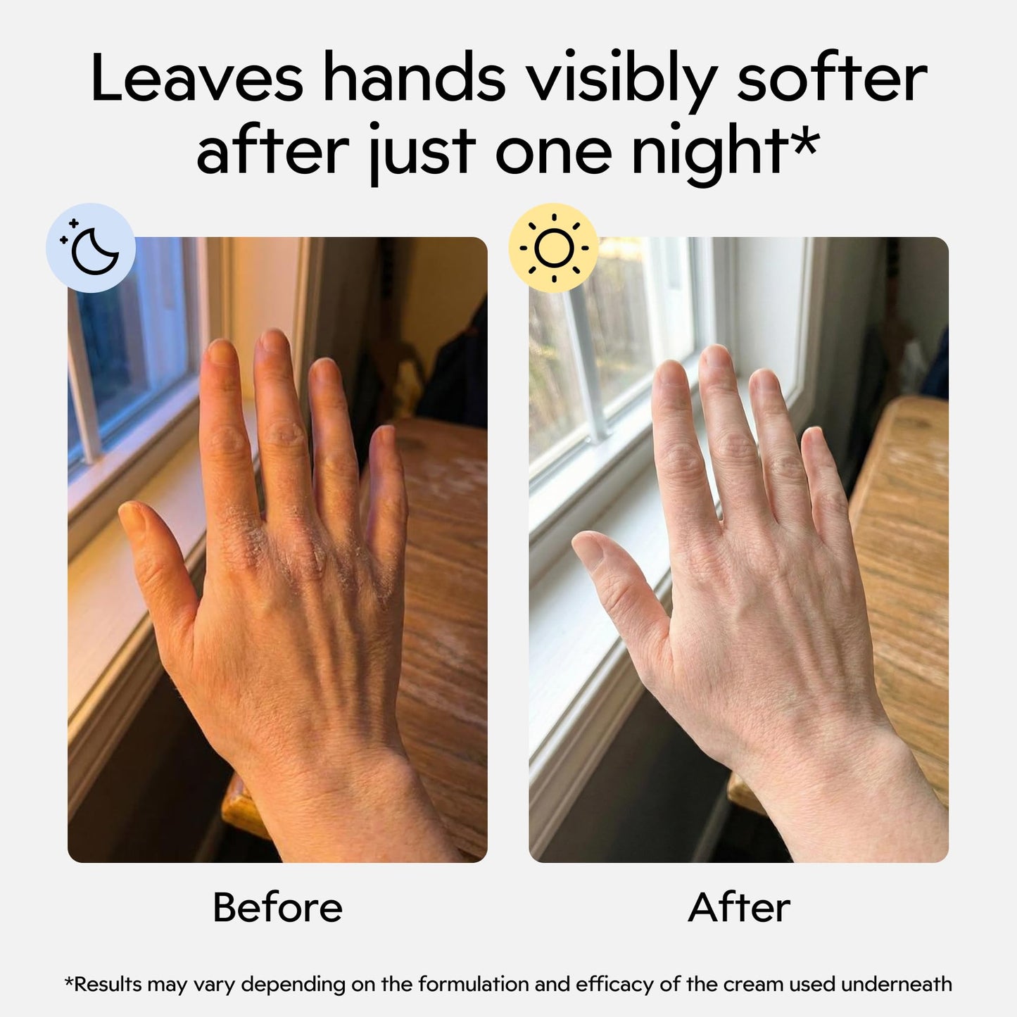 Clearbody Organics 100% Cotton Gloves for Dry Hands Sleeping, L, 5 Pairs
