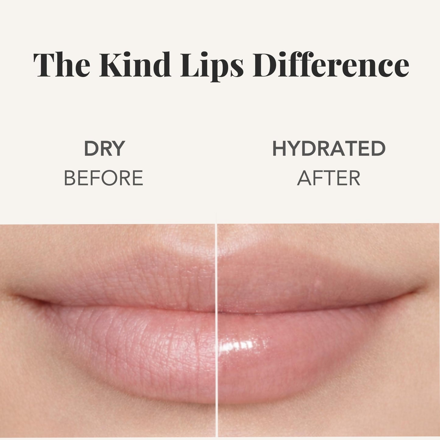 Kind Lips Wild Cherry Lip Balm (5 Pack) – Organic Flavored Lip Balm for Dry, Cracked Lips – Natural Beeswax Moisturizing Lip Care with Sweet Cherry Flavor