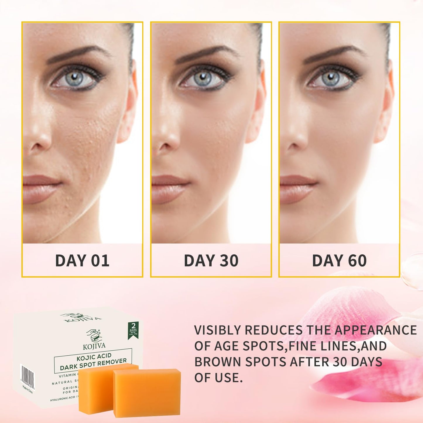 Kojiva Kojic Acid Dark Spot Remover Soap, 2 Bars (3.5 oz each), with Vitamin C, Retinol, Turmeric, Natural Skin Brightening