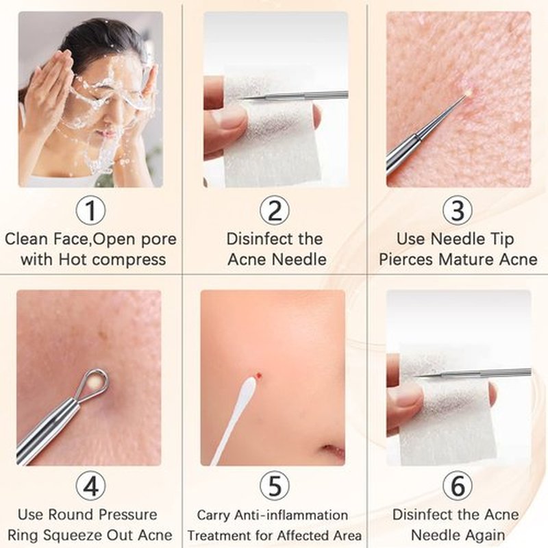 TAYTHI Blackhead Remover Tool, Pimple Popper Tool Kit, Blackhead Extractor Tool for Face, Extractor Tool for Comedone Zit Acne Whitehead Blemish, Stainless Steel Extraction Tools (Pack of 2)