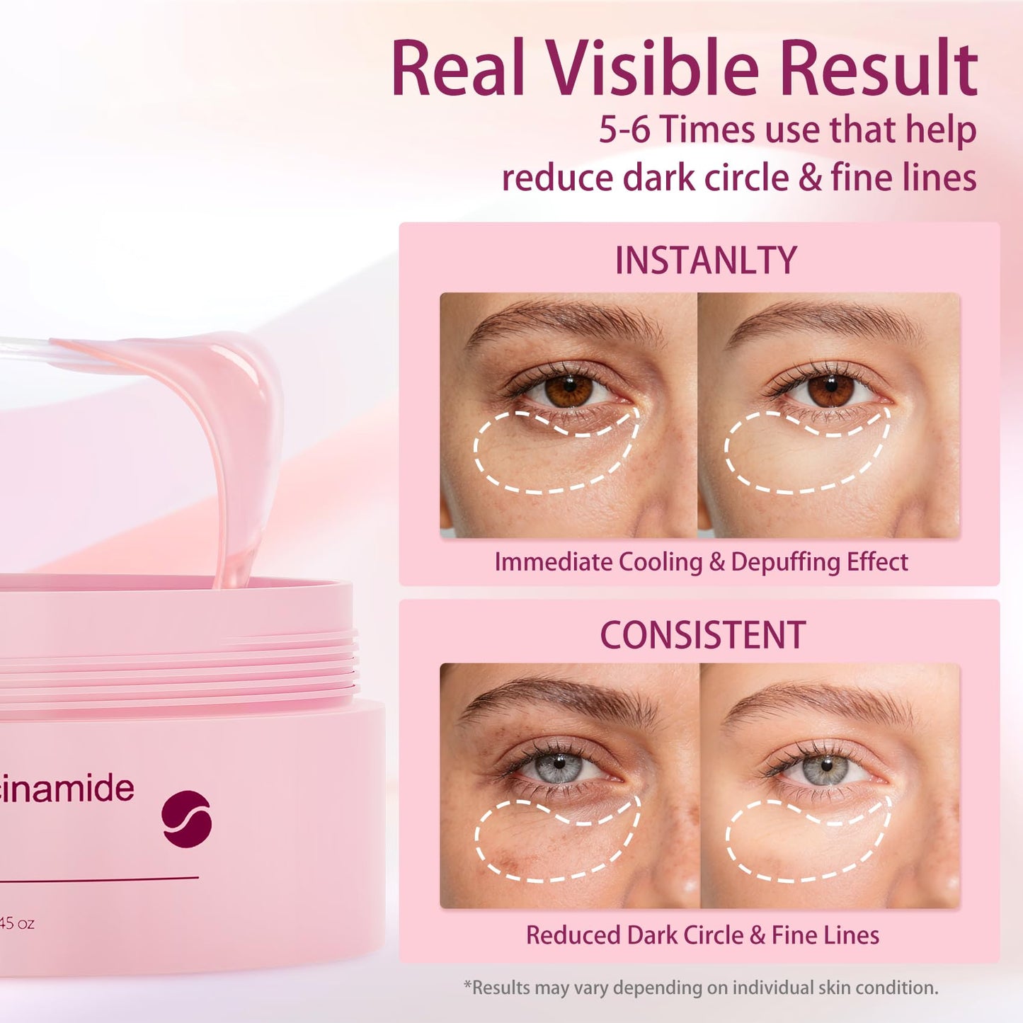 AveCera 70Pcs Caffeine Peptide Under Eye Patches for Dark Circles Puffiness, Gel Eye Masks with Rose Essence Hyaluronic Acid Niacinamide Anti Wrinkle & Fine Lines Hydrating & Cooling for Men & Women