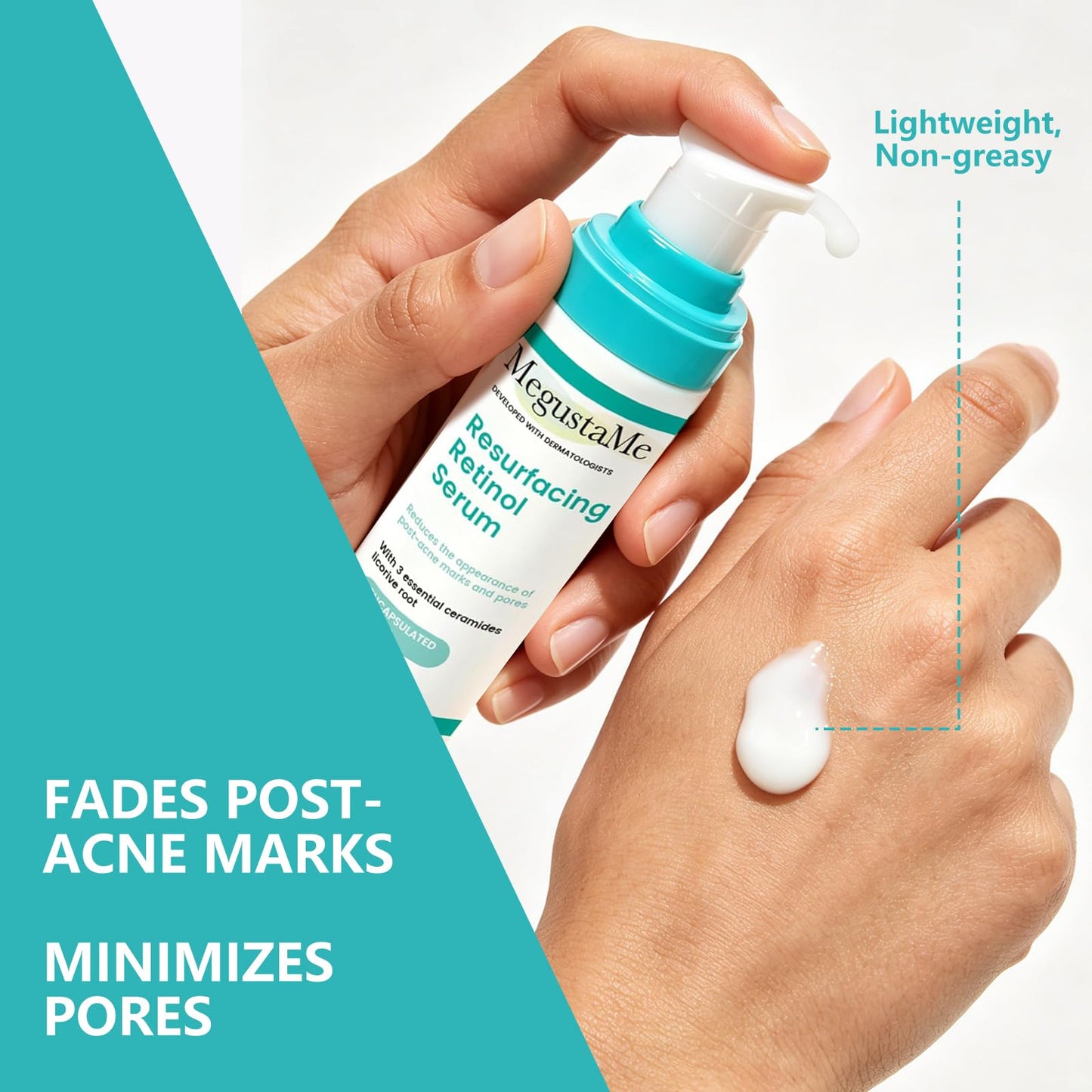 MegustaMe Resurfacing Retinol Serum for Acne Scars & Pores, 30ml. Encapsulated Retinol for Sensitive Skin, Gentle Anti-Aging with Less Irritation. Dermatologist-Developed.