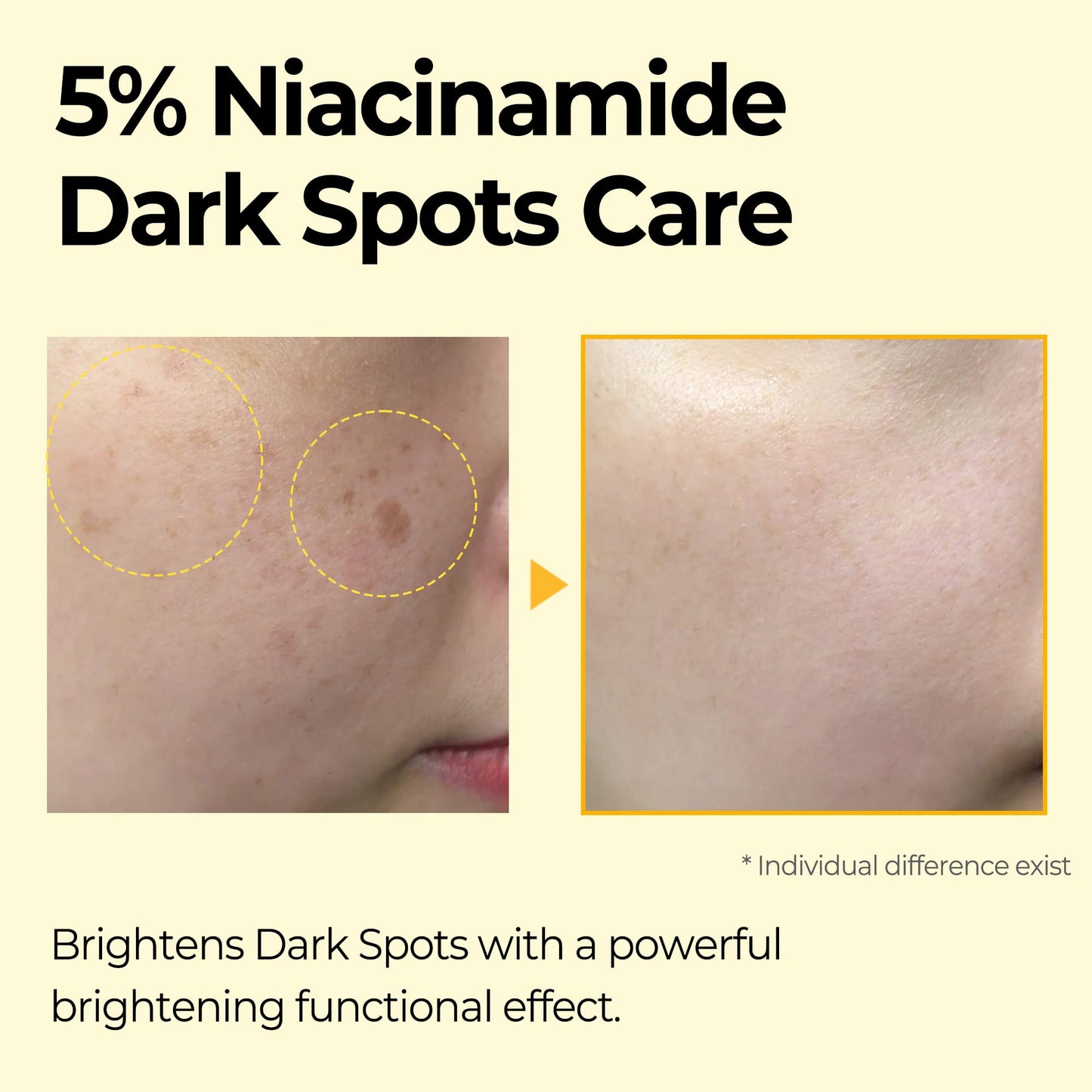 SOME BY MI Yuja Niacin Dark Spot Correcting Stick - 0.35Oz, 10g - Made from Yuja Extract for Sensitive Skin - Brightening and Calming Balm - Dark Spot, Blemishes and freckles Care - Facial Skin Care