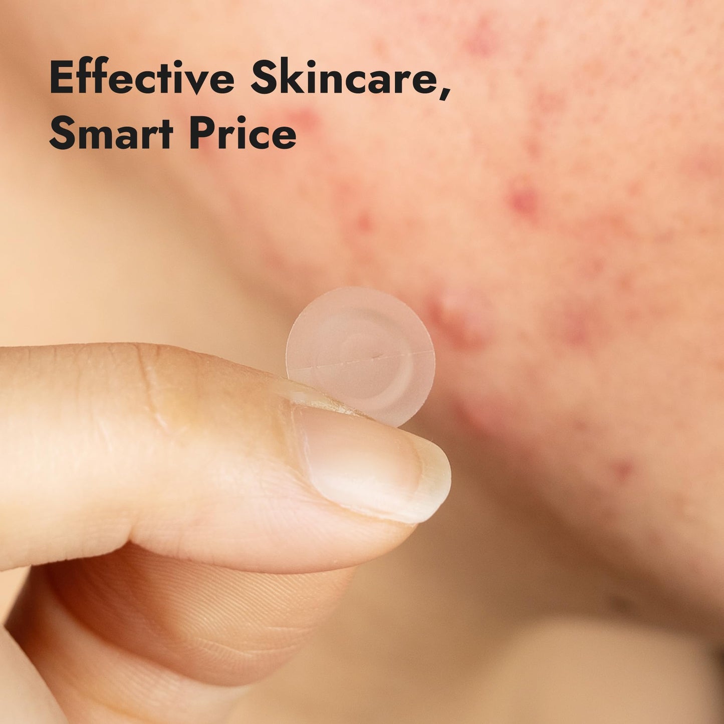 Epielle Acne Clear Patch Over-Zit - The Ultimate Hydrocolloid Solution of Acne Clear Patch (138 Ptches) Acne Pimple Patches Blemish Patches