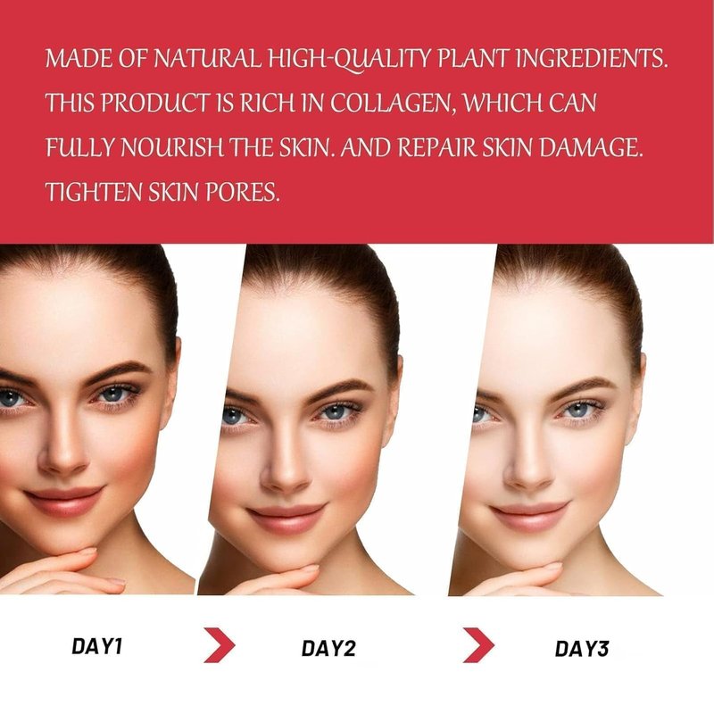 Intimate Skin Brightening Cream - Underarm & Bikini Area Lightener | 30ML/1.0 FL.Oz