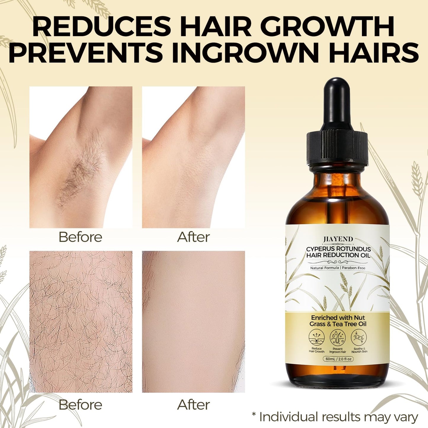 Jiayend Cyperus Rotundus Oil,Cyperus Rotundus Hair Removal Oil, Rich in Cyperus and Tea Tree Extracts, Reduces Unwanted Hair and Inhibits Growth, Soothes and Nourishes the Skin
