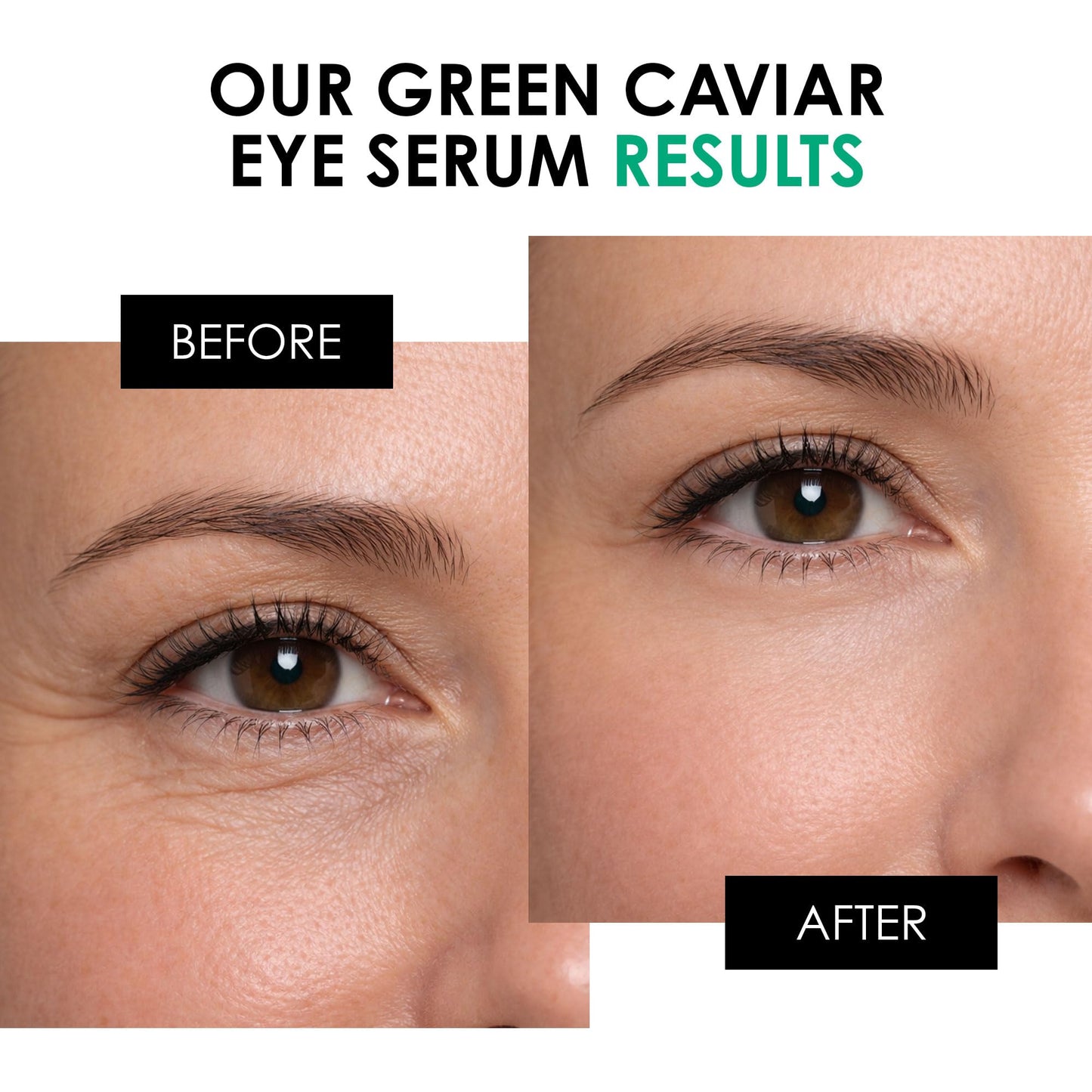 skinChemists Anti-Aging Eye Serum, 15ml - Green Caviar Extract & Matrikine Peptide 6 for Under Eye Wrinkle Reduction, Hydrating and Elasticated Skin