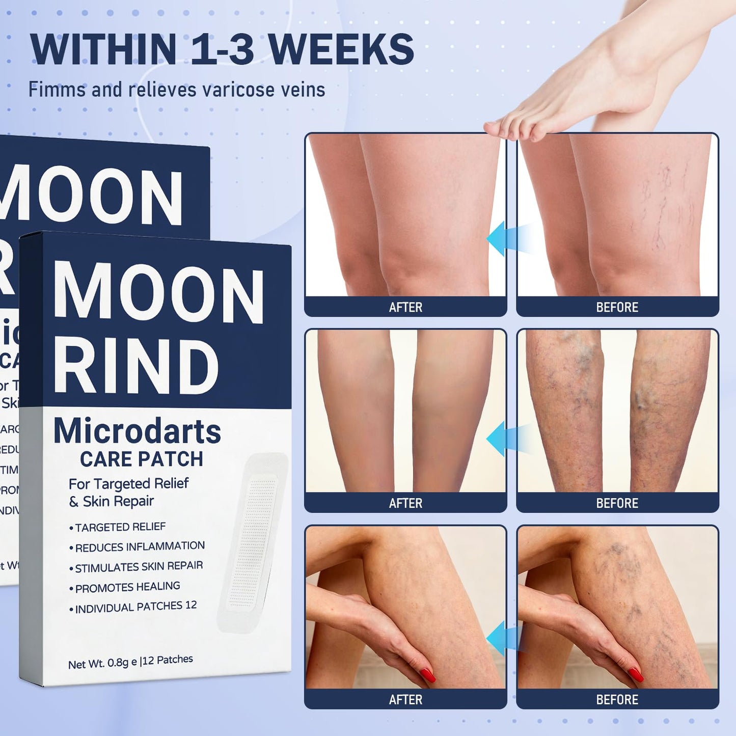 HENGRUNXIN Moonrind Vein Target Microdarts Care Patch, Relieve Leg Discomfort, Effectively Moisturizes, Deep Moisturizing Skin Treatment Mask for Leg Fatigue and Soreness (2PCS, 2 Box)