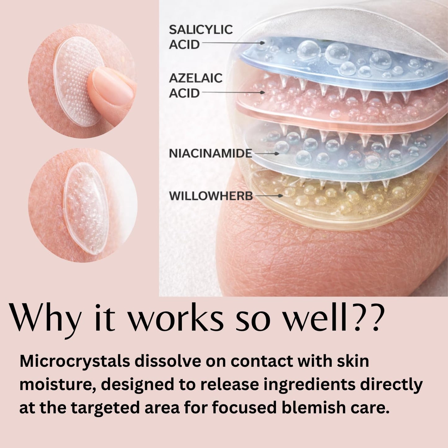 ivoryloom Microdart Spot Patch | Targeted Blemish Care with Salicylic Acid, Azelaic Acid, Niacinamide and Willowherb | For Early-Stage Blemishes | 8 Patches