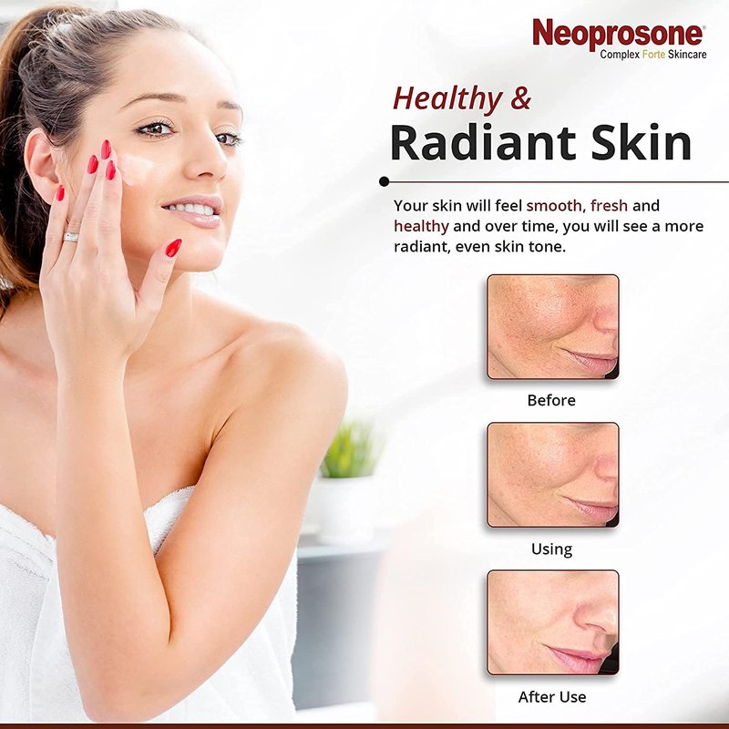 Brightening Body Lotion - Neoprosone 400ml | Reduces Dark Spots, Enhances Skin Tone with Vitamin C & Alpha Arbutin