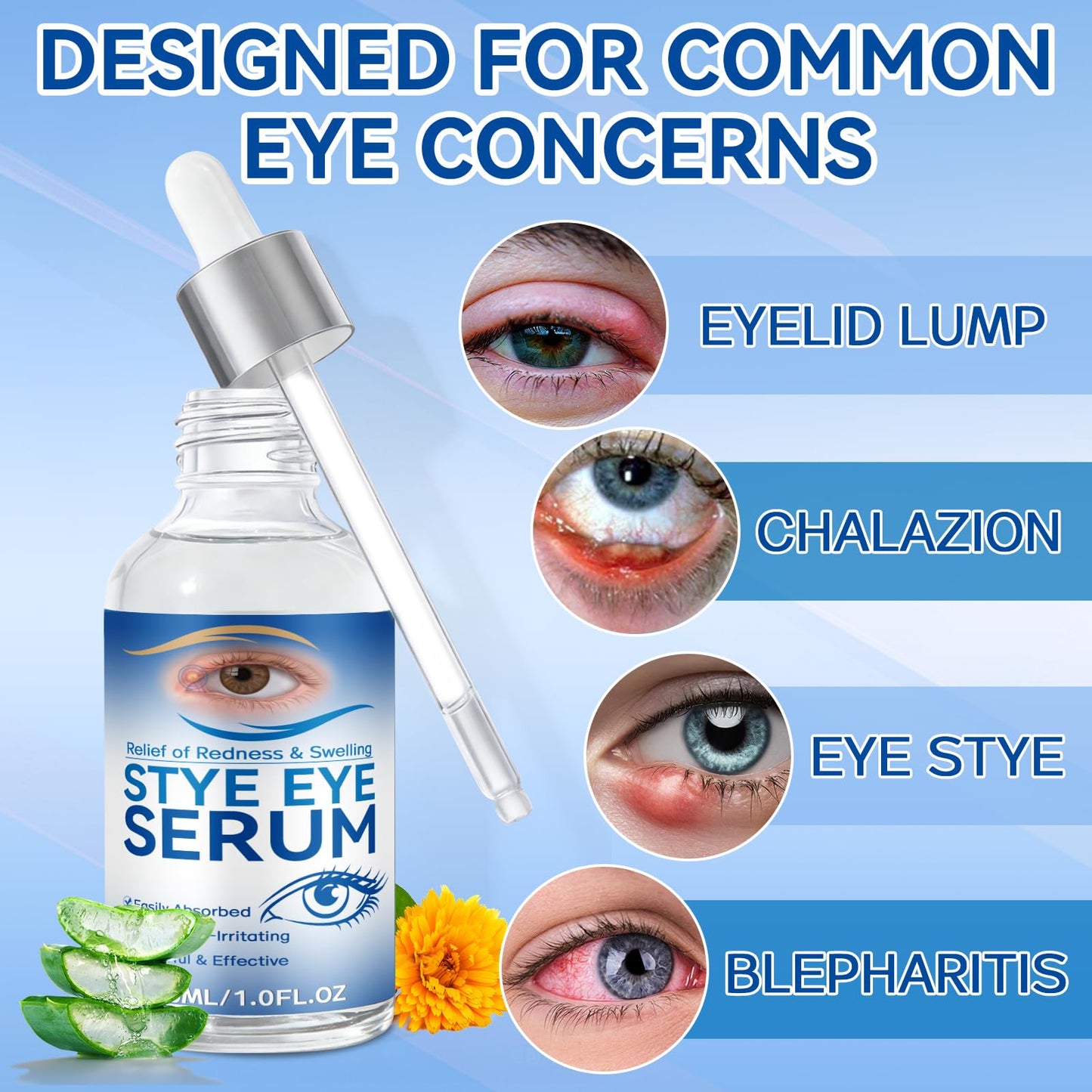 Stye Eye Treatment, 30ml Natural Eye Serum, Eye Stye Relief Serum for Eye Styes, Blepharitis, Chalazions and Dry Eyes Treatment, Daily Area Cleansing, Relieves Dryness and Restores Healthier Skin