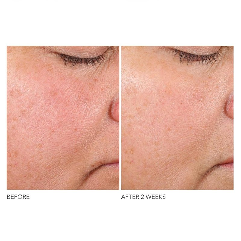 Dr. Dennis Gross Advanced Retinol Serum - Anti-Aging Formula to Smooth Texture & Minimize Fine Lines | 1 oz