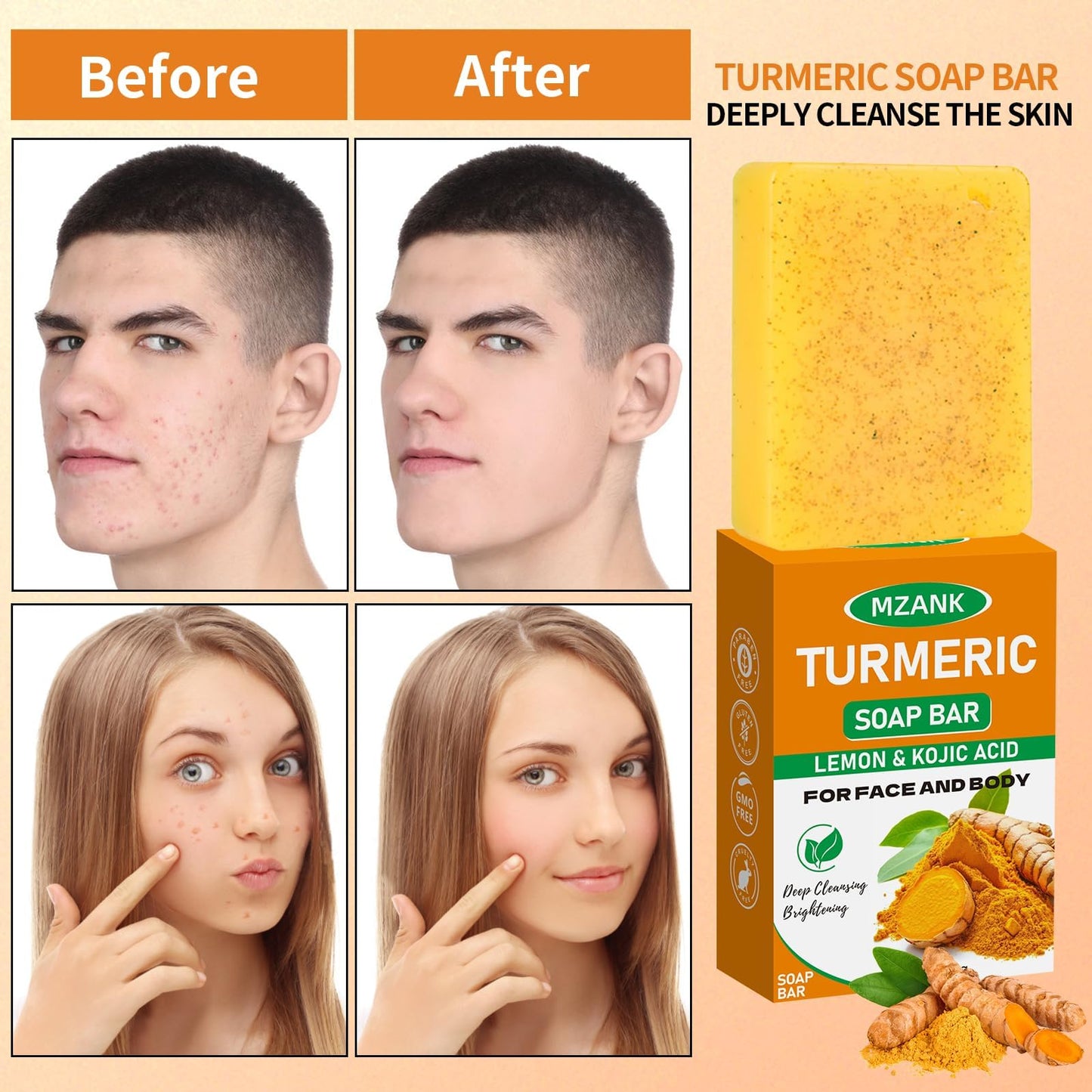MZANK 2 Pack Kojic Acid Soap,Dark Spot Remover Turmeric Soap Bars Moisturizing with Collagen,Vitamin,Hyaluronic Acid,Retinol,Shea Butter,Tumeric Soaps for Face Body All Skin Types