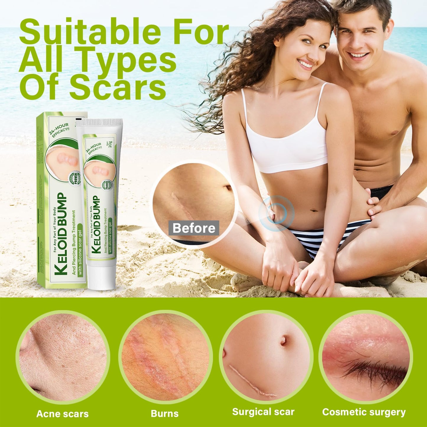Keloid Bump Removal
