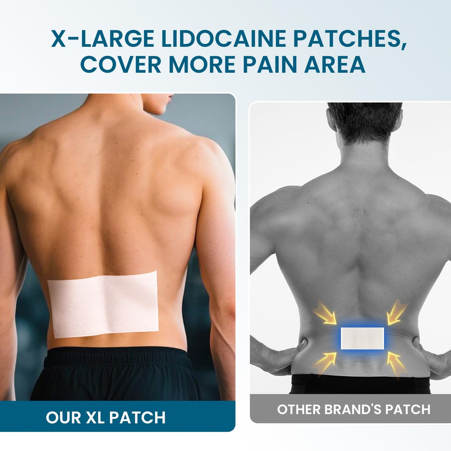Sumifun Extra Large Lidocaine Patches - 4.72"x7.87" | 4% Lidocaine Maximum Strength for Lower Back & Sciatica | 8-Hour Long Lasting Relief (Extra Large, Count, 17)