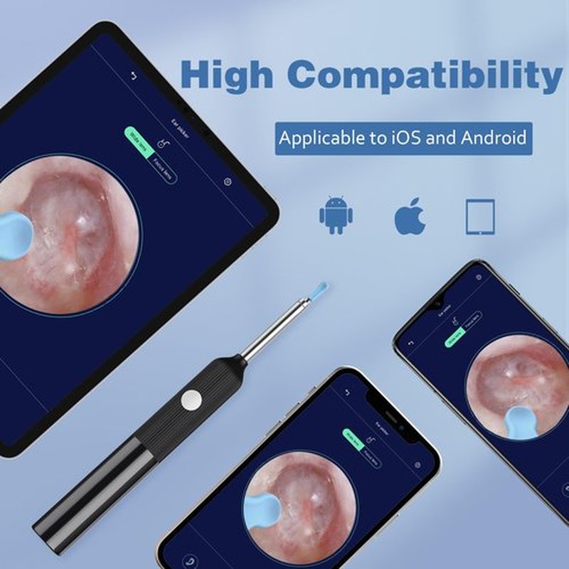 Flex-Whol Ear Wax Removal Tool Camera, Ear Cleaner with 7 Pcs Ear Set, Ear Wax Removal Kit with 1080P Camera and 6 Led Lights, Ear Cleaning with 8 Replacement Ear Tips for iOS & Android (Black)