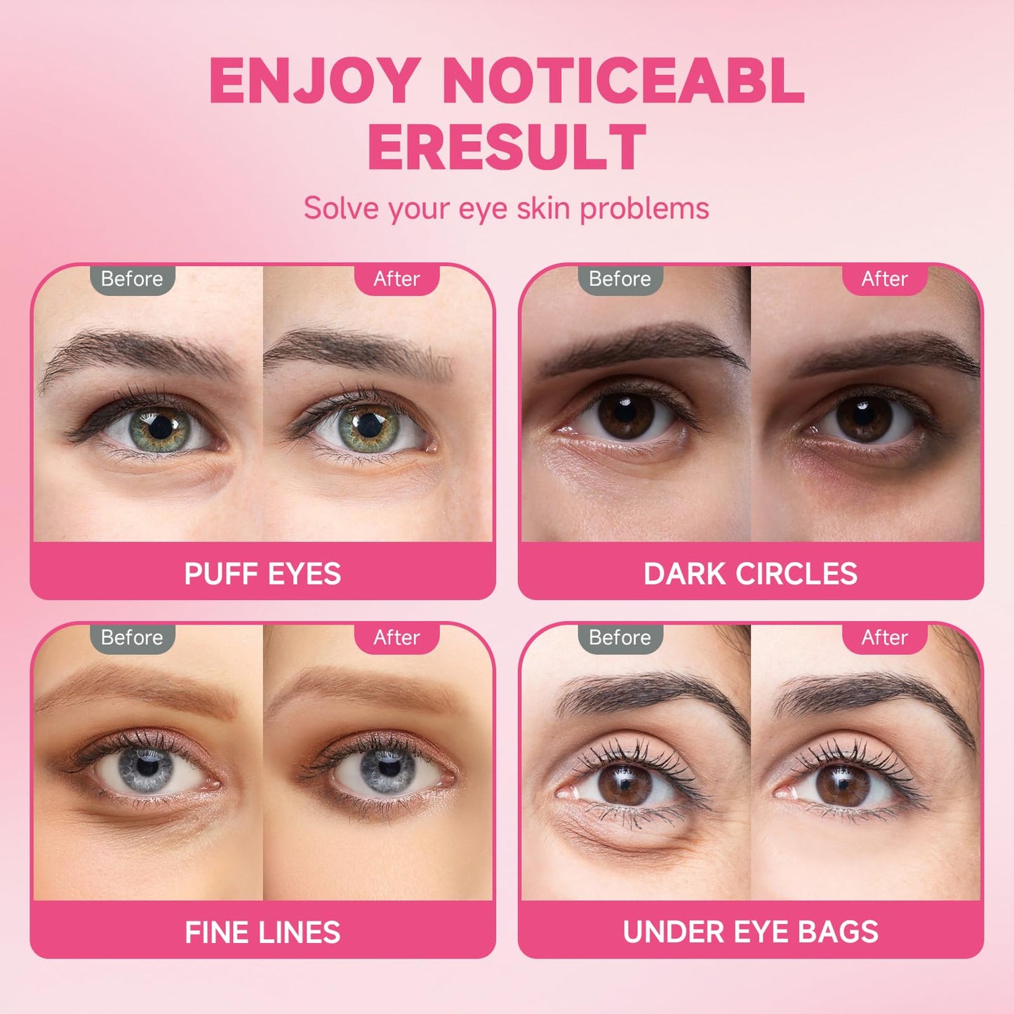 POSTA 20Pairs/40Pcs Collagen Under Eye Patches, Glitter Under Eye Mask for Dark Circles and Puffiness, Hydrating Eye Skincare Reduce Wrinkles and Fine Lines, Eye Gels Pads for Beauty Personal Care