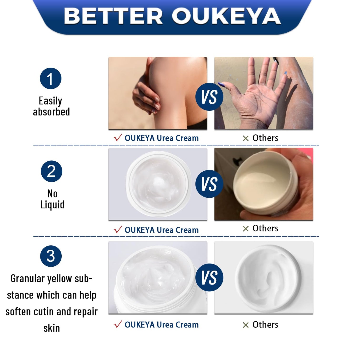 OUKEYA Urea Cream 40 Percent, Foot & Hand Cream for Dry Cracked, Urea Lotion for Feet Maximum Strength