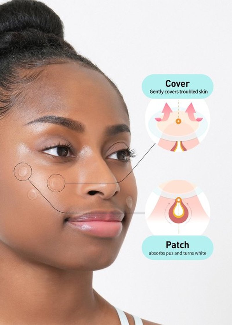 OLIVE YOUNG Care Plus Spot Patch 3 Pack | Hydrocolloid Acne Korean Spot Patch to Cover Zits, Pimple | Invisible Acne Patches for Troubled Skin (306 Count-10mm*216ea + 12mm*90ea)