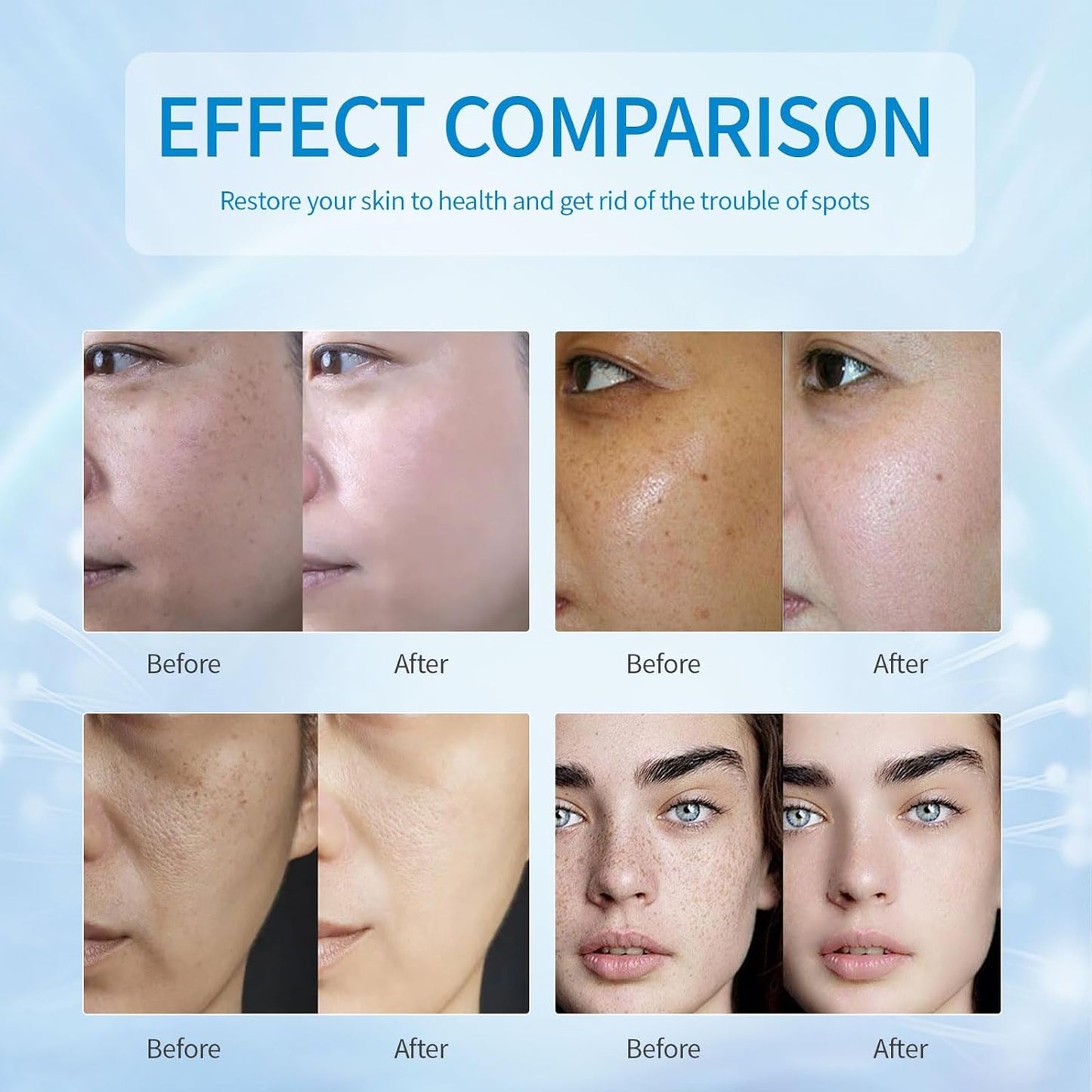 Dark Spot Remover for Face, Dark Spot Corrector, Dark Spot Serum for Sun Spots, Age Spots, Brown Spots,Acne Scars,Melasma Brown Spot -Advanced Formula with Niacinamide Vitamin C (1 Fl Oz (Pack of 1)