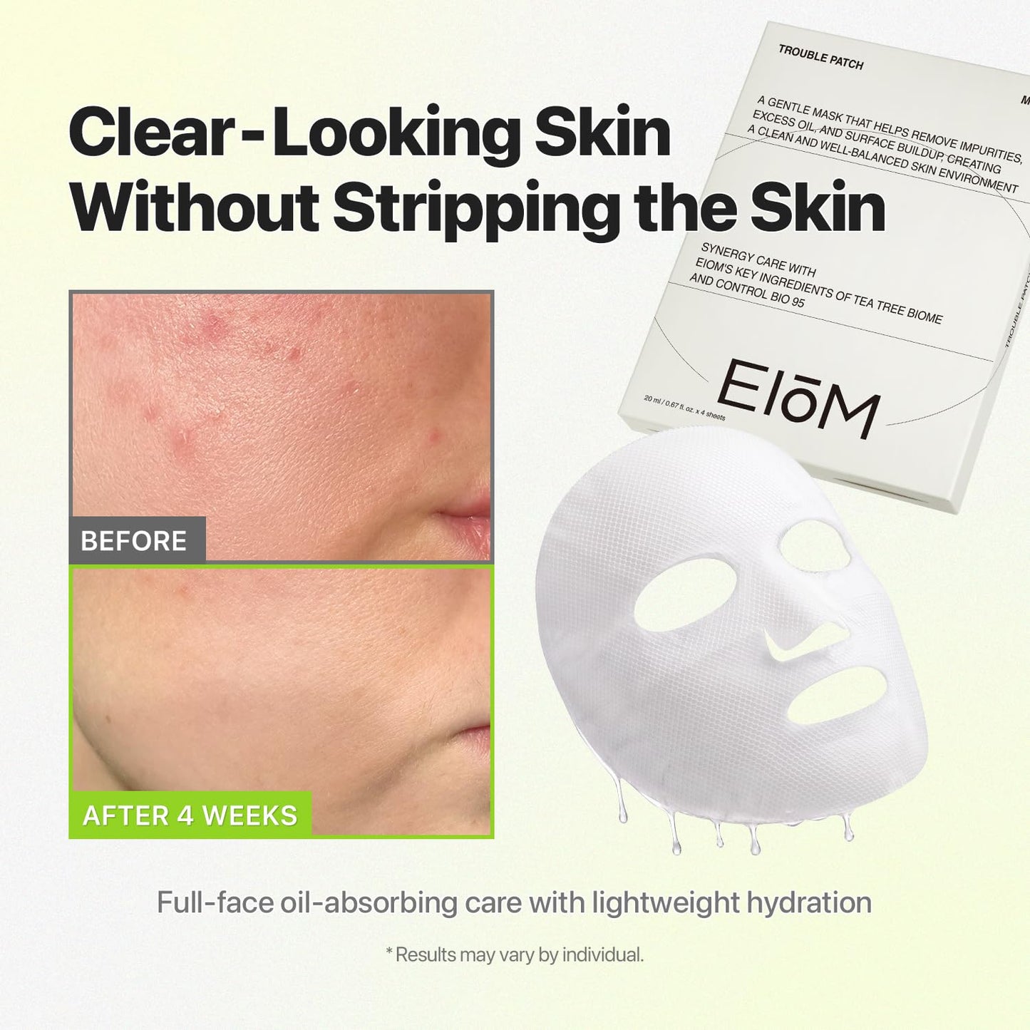 EIOM Trouble Patch Mask – Full Face Sheet Mask for Acne-Prone Skin | Sebum-Absorbing Oil Control, Pore Purifying, Tea Tree Biome, Korean Skincare Acne Face Mask, Hydrocolloid-Infused Sheet (20ml x 4)