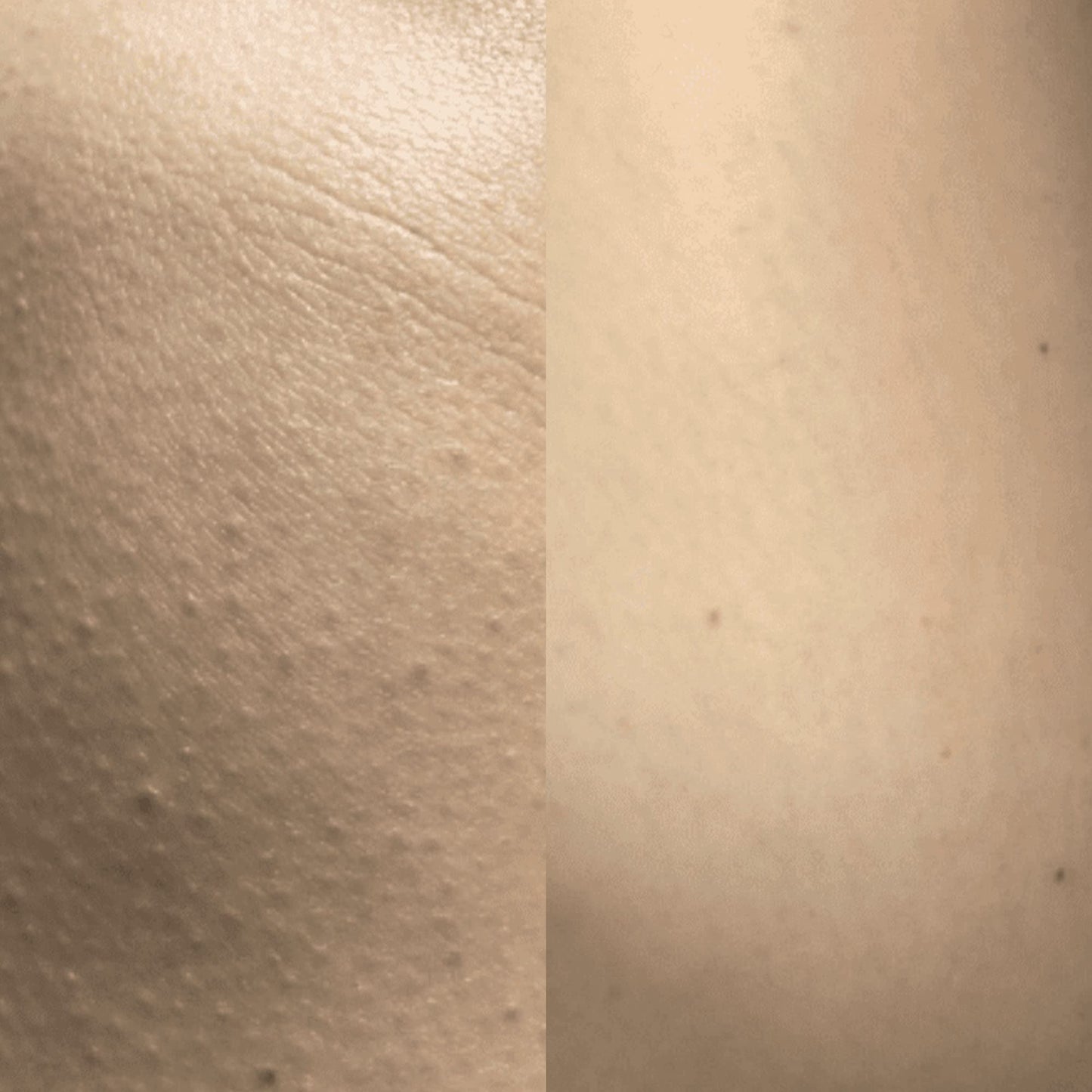 AMELIORATE Transforming Body Lotion for Keratosis Pilaris, 500ml