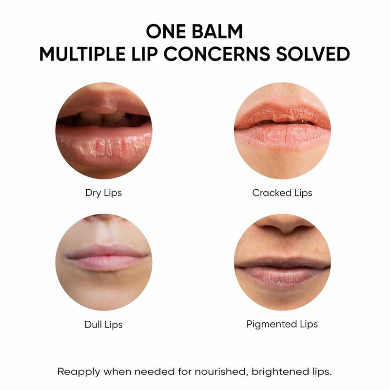 Shea Butter Lip Balm with Kojic Acid & Alpha Arbutin - Smooth, Hydrated Lips | SPF 30, 0.52 oz