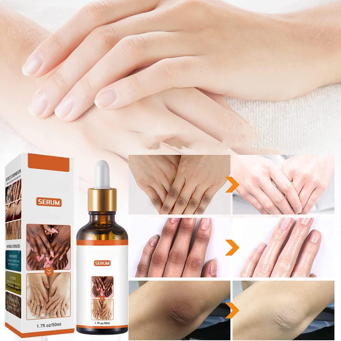 JASUBAI Body Moisturizing Serum for Dry Skin, Nourishing for Elbows, Knees and Fingers