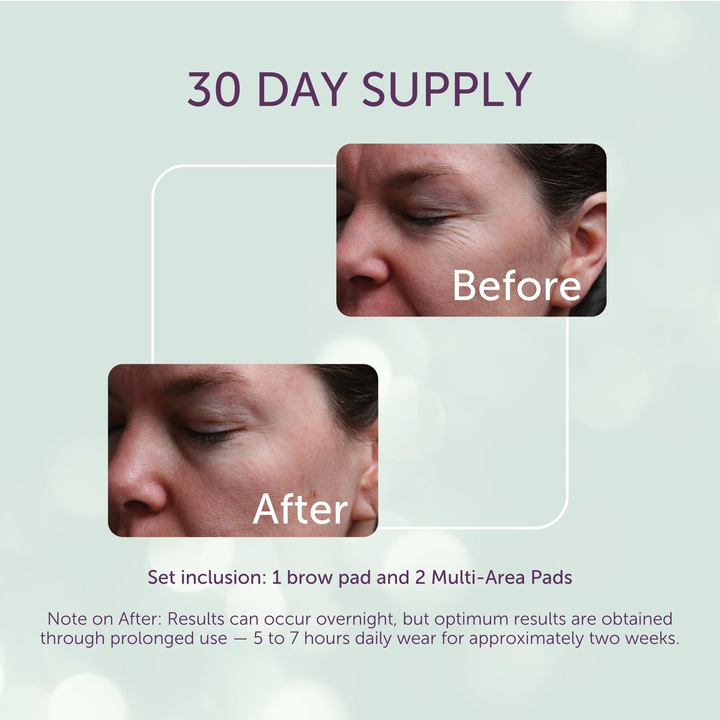 Silcskin Facial And Brow Pads Set Reusable Silicone Pads For Forehead And Facial Areas, 30 Day Supply