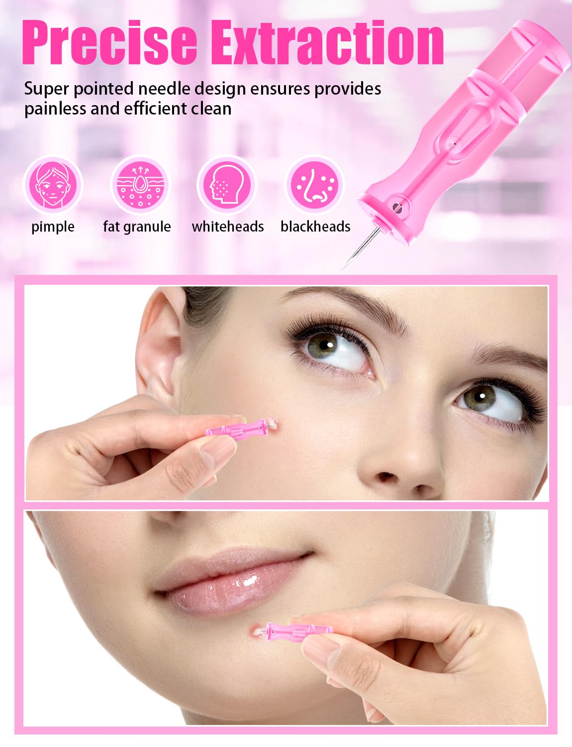 Lancets for Facial Extraction, 50Pcs Pink Disposable Acne Needle Tools, Blackhead Removal Kit for Clear Skin