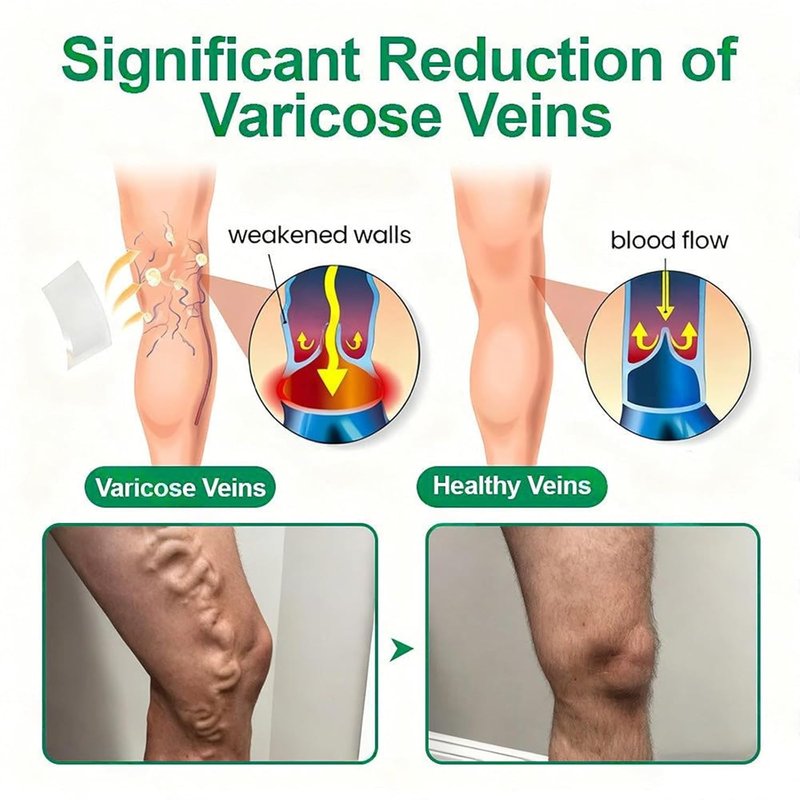 Healrize Vein Target Microdarts Patch - Natural Varicose Vein Treatment for All Skin Types | 1 Box
